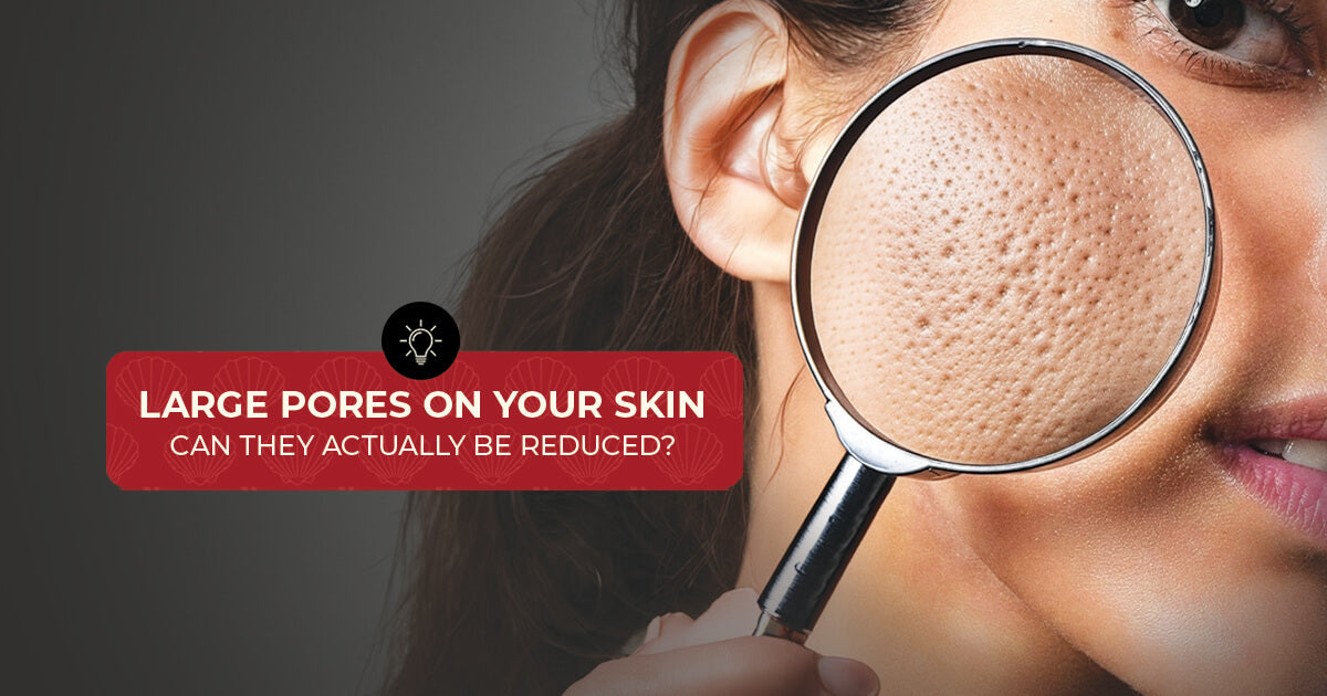 Large Pores on Your Skin: Can They Actually Be Reduced?