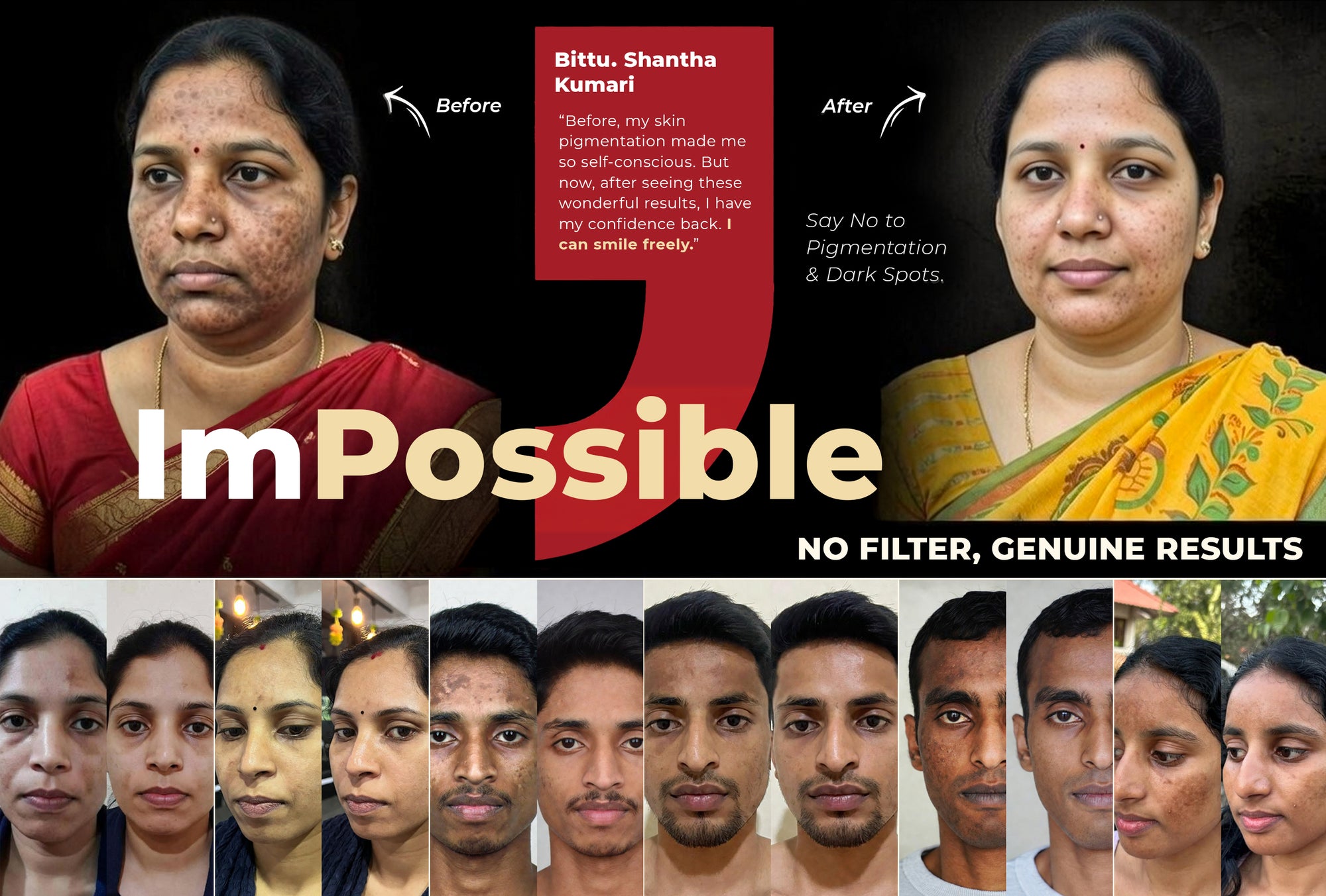 Skin Brightening & Pigmentation Cream