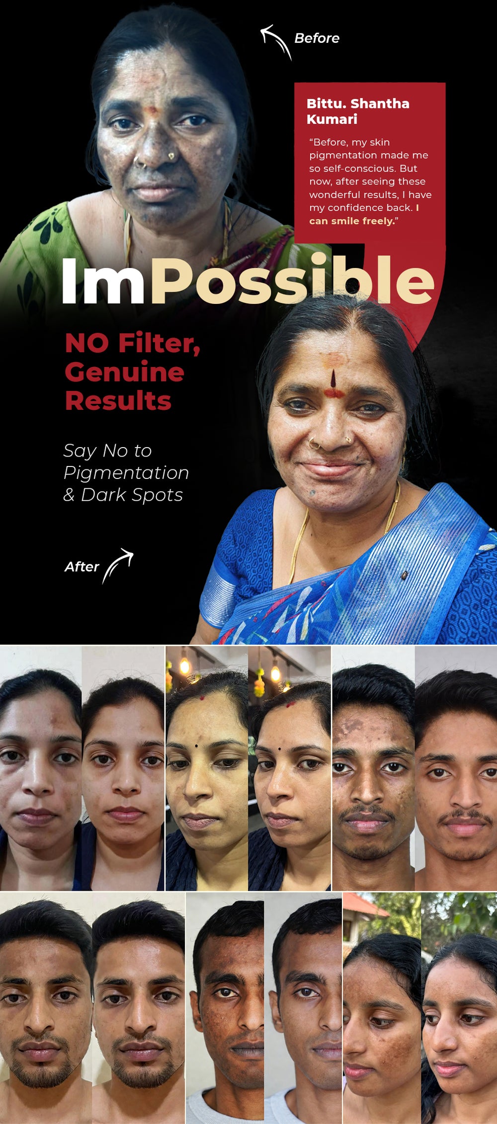 Skin Brightening & Pigmentation Cream