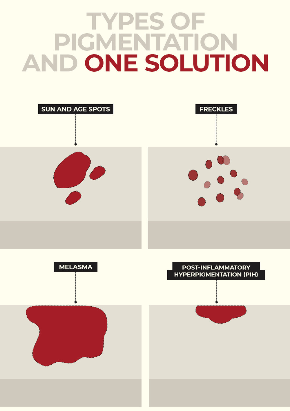 Skin Brightening & Pigmentation Cream